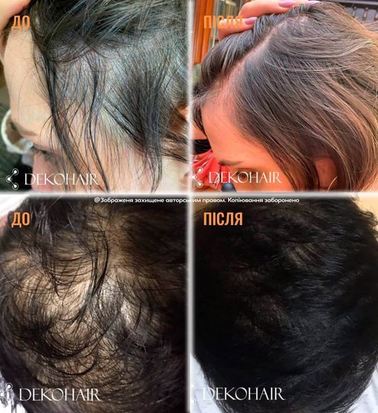 Charismo Dekohair Dekopill 60ml Лосьон для укрепления волос, инновационное средство для ежедневного ухода за волосами 36947 фото