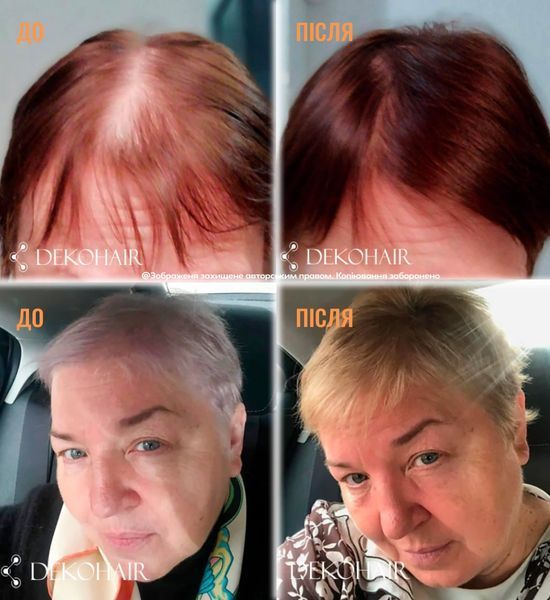Charismo Dekohair Dekopill 120ml Лосьйон для зміцнення волосся, інноваційний засіб для щоденного догляду за волоссям (Оригінал) 36948 фото